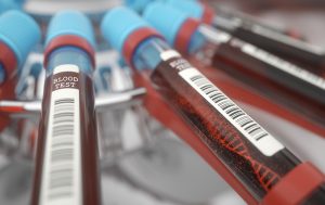 biomark diagnostics liquid biopsy test tubes with dna blood samples