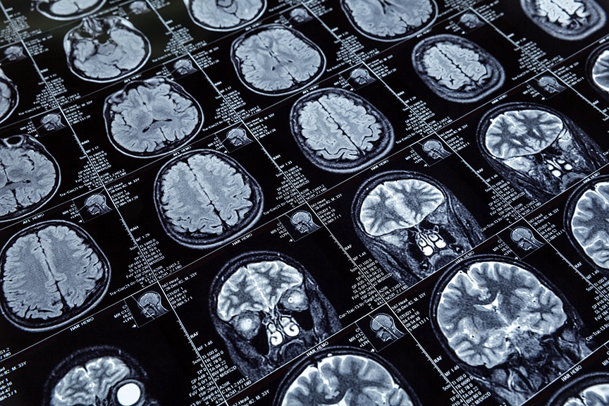 Magnetic resonance imaging